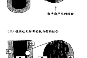 鈦纖維醫(yī)療材料