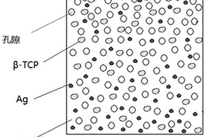 多相梯度分布的多孔Zn-Ag-TCP復(fù)合材料及其制備方法