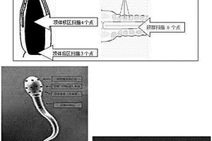 非侵入性精子形態(tài)和超微結(jié)構(gòu)分析方法