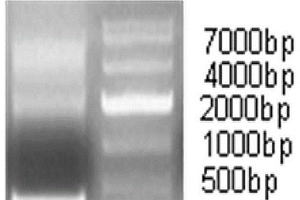 檢測(cè)人可溶性CD14的化學(xué)發(fā)光試劑盒