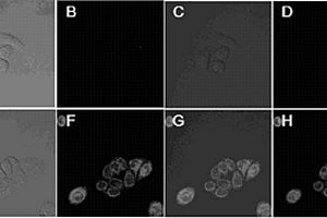 基于羅丹明衍生物的檢測(cè)細(xì)胞內(nèi)亞硝酰氫的熒光探針