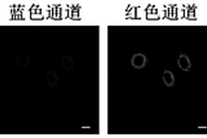 檢測溶酶體內(nèi)生物硫醇的熒光探針及其制備方法和應(yīng)用