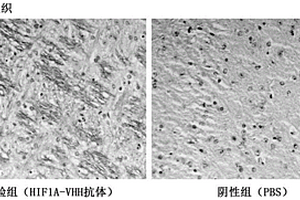 HIF-1α納米抗體、檢測(cè)試劑盒及其應(yīng)用