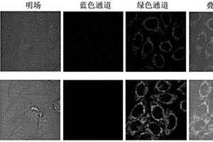 檢測(cè)細(xì)胞內(nèi)質(zhì)網(wǎng)半胱氨酸的熒光探針及其合成和應(yīng)用
