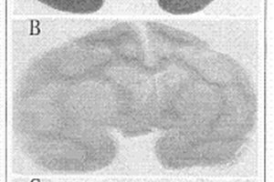 用已經(jīng)染色的陳舊腦組織切片做分子雜交的方法和應(yīng)用