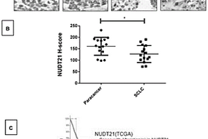 NUDT21基因在制備治療肺癌藥物中的應(yīng)用