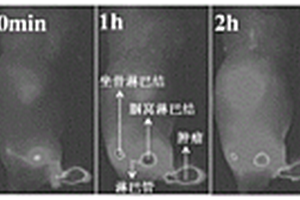 基于腫瘤前哨淋巴結(jié)探測(cè)的熒光造影劑及其制備方法