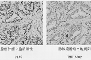 抗Napsin A蛋白的單克隆抗體及其細胞株、制備方法和應用