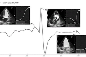 運動員心臟左室內(nèi)相對壓力無創(chuàng)測量方法