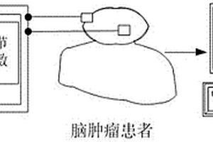 基于磁共振電阻抗成像的腦部腫瘤檢測系統(tǒng)